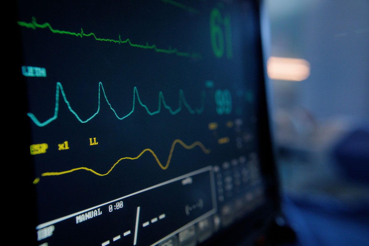 Shock Anxiety After Electrical Storm Ventricular Tachyarrhythmias Treated With Cognitive-Behavioral Therapy
